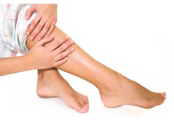 varices